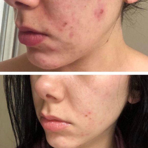 Koffee Beauty Scrub - Picture 8 of 11